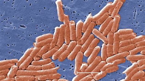 Nationwide Salmonella outbreak kills one and sickens nearly 1,000 ...