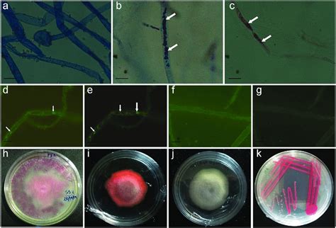 Observation of fungal hyphae of hyphae of fungal sample SS7 under light ...