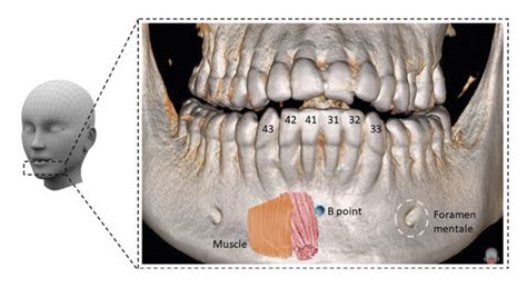 Anatomical structures of lower jaw. | Download Scientific Diagram