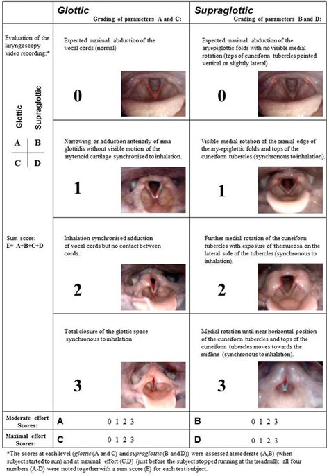 | Grading system of laryngeal obstruction according to Maat et al ...