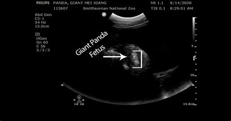 Veterinarians Find Fetal Tissue on Giant Panda Ultrasound | Smithsonian ...