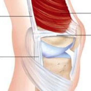 Medial Patellofemoral Ligament (MPFL) - Gorav Datta