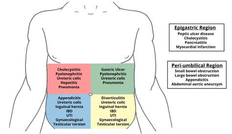 The Acute Abdomen - Causes - Management - TeachMeSurgery