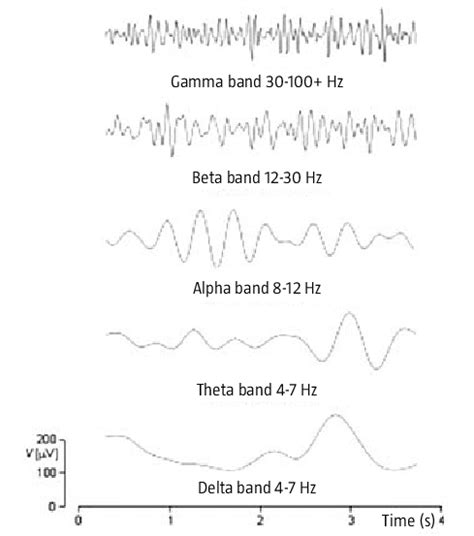 Brain waves noted by electroencephalogram (EEG). | Download Scientific ...