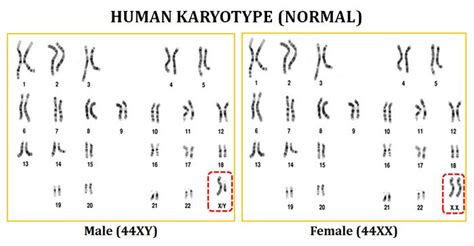 Karyotype Analysis of Human Chromosome | easybiologyclass