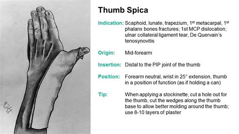 SplintER Series: Common ED Splint Techniques | Splint Principles 104