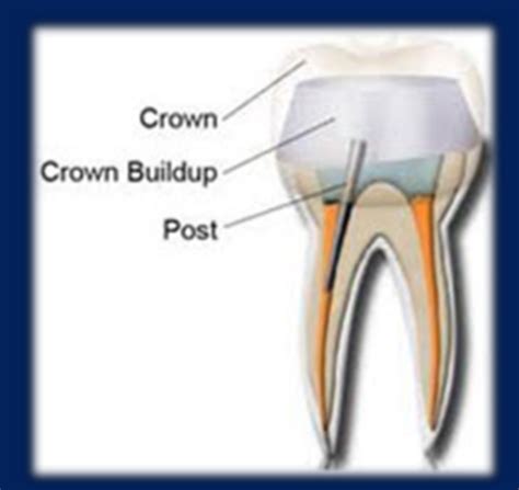 Crown Quiz 4 Flashcards | Quizlet