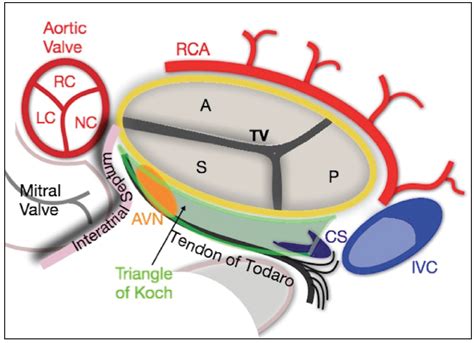 Cardiac Interventions Today - Echocardiography for Tricuspid Valve ...