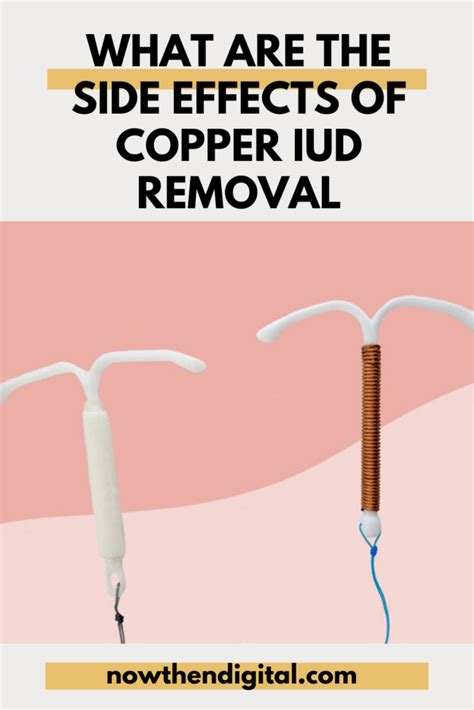 Removal of Copper IUD: When and What to Expect - Now Then Digital