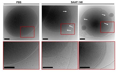 Biofilm Buster Treats Drug-Resistant Infectio | EurekAlert!