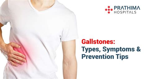 Gallstones: Types, Symptoms and Prevention Tips | Prathima Hospitals