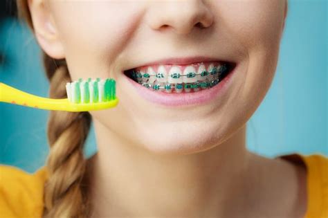 How to Brush Your Teeth with Braces - Duff Family Dental