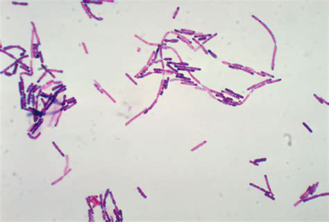 Bacillus Cereus Gram Stain