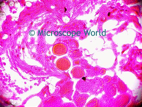 Microscope World Blog: Optic Nerve under the Microscope