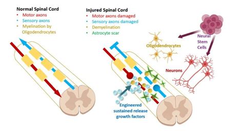 Spinal Cord Injury Program - Neural Stem Cell Institute, Rensselaer NY