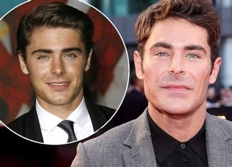 Zac Efron's Plastic Surgery: His Explanation For Why His Appearance Has ...