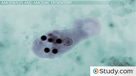 Entamoeba Histolytica & Amoebic Dysentery: Causes, Symptoms & Treatment ...