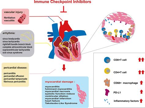 Frontiers | Immune Checkpoint Inhibitor-Associated Cardiotoxicity ...