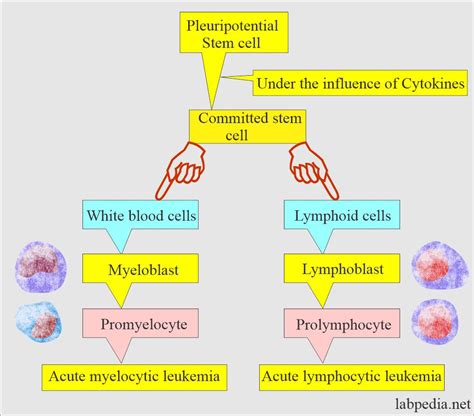 Acute Myeloid Leukemia Pathophysiology | Hot Sex Picture