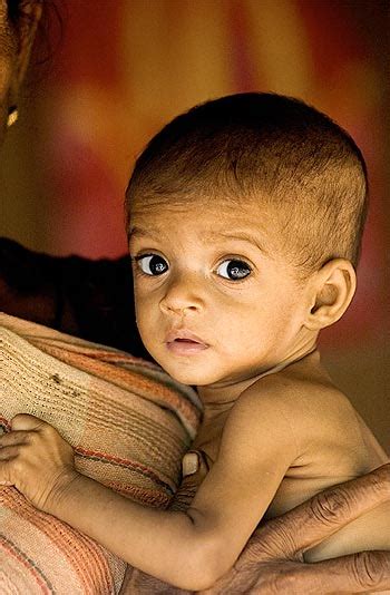 3,000 children die of malnutrition in India everyday - Rediff.com News