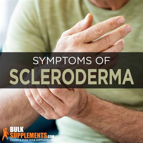 Systemic Scleroderma Hands