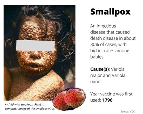 List: Diseases prevented by vaccines | World – Gulf News