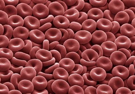 How Hemoglobin and Diabetes Are Related