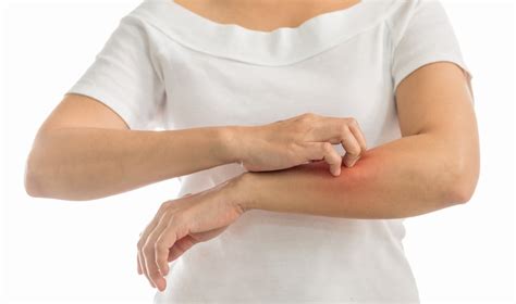 Symptoms and Treatments of Pruritus - Facty Health