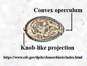 Clonorchis sinensis – Egg – Parasitology