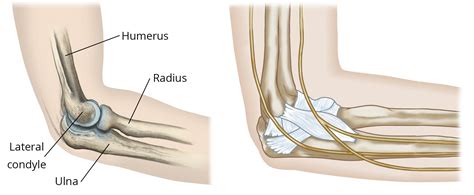 Ulna Elbow Fracture