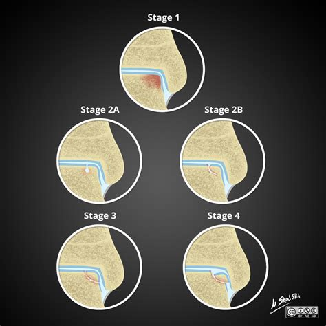 Viewing playlist: AA-JUNEPIN | Radiopaedia.org | Radiology, Medical ...