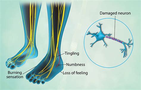 Health Symptoms : Causes, Treatment, Conditions and More