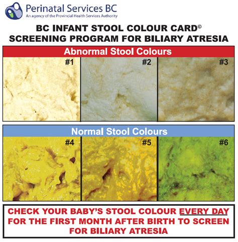 Blanket? Check. Car Seat? Check. Poop colour chart? Huh? - UBC Faculty ...