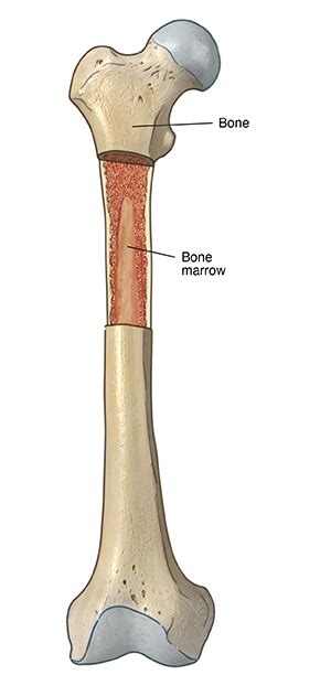 Bone Marrow Biopsy | University Hospitals