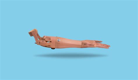 Which companies work on developing robotic prosthetic arms? : AskEngineers