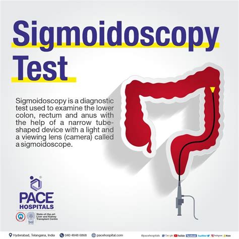 Sigmoidoscopy Test in Hyderabad | Indications, Purpose, Effects & Cost