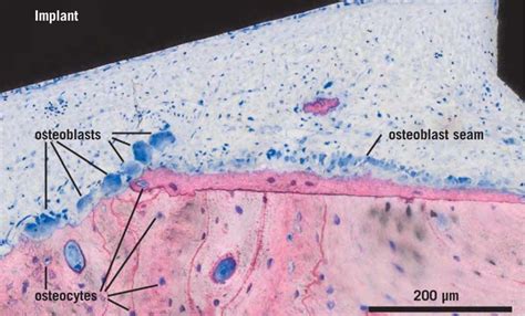 Osteoclasts And Osteoblasts Histology