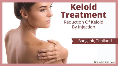 Keloid Treatment (Reduction Of Keloid By Injection) | Trambellir