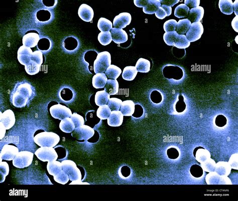 ENTEROCOCCUS, SEM Stock Photo - Alamy