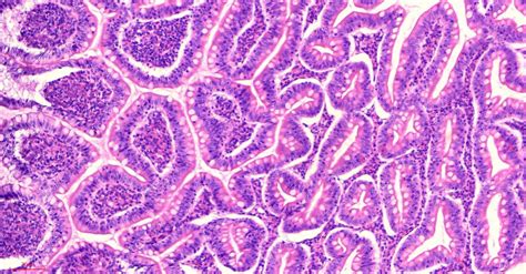 Human ileum cross-section histology slides, 7 µm sec., H&E Stain, human ...