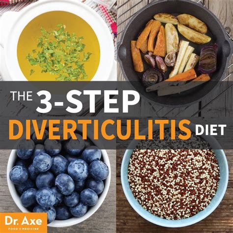 3-Step Diverticulitis Diet & Treatment Plan — Info You Should Know