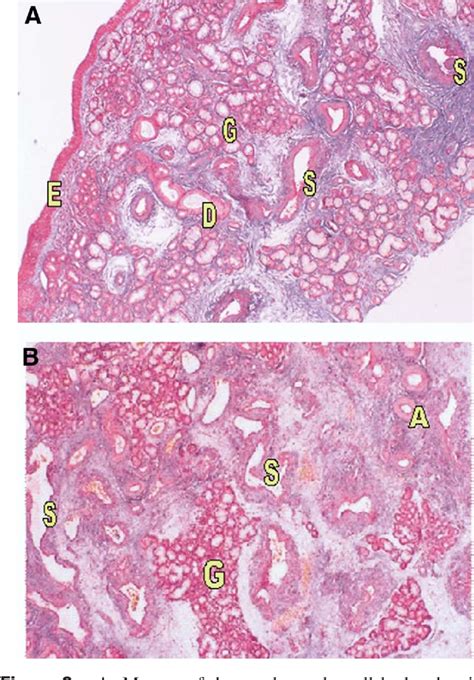 Figure 2 from Histology of the Nasal Septal Swell Body (Septal ...