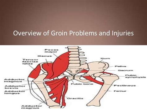 Groin Muscles Diagram Groin Muscles Diagram Diagram Of Groin | Images ...