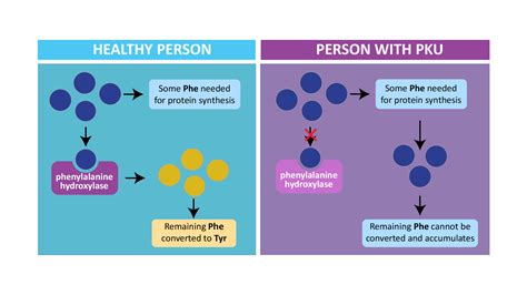 Phenylketonuria (PKU)- Treatment, Prevention, Dietary management ...