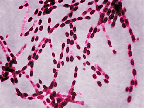 Anthrax Types, Risk, and Treatment