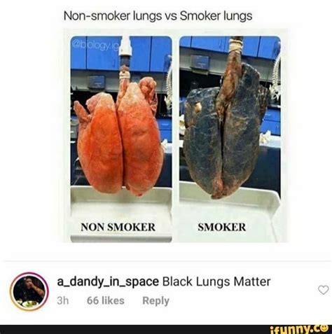 Non-smoker lungs vs Smoker lungs NON SMOKER SMOKER a_dandy_in_space ...