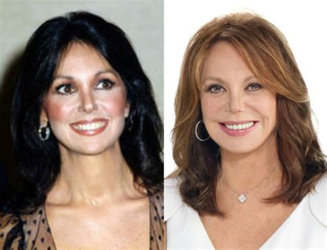 Marlo Thomas Plastic surgery for 76 year old!