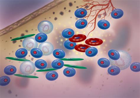 What is a Bone Marrow Biopsy and How Does it Work?