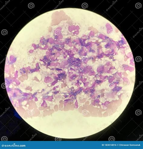 Phagocytosis Microscope