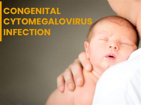 Congenital Cytomegalovirus (CMV) Infection: Causes, Symptoms, Risk ...